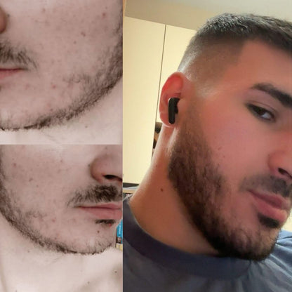 Kit pentru creșterea bărbii – Mega Pack