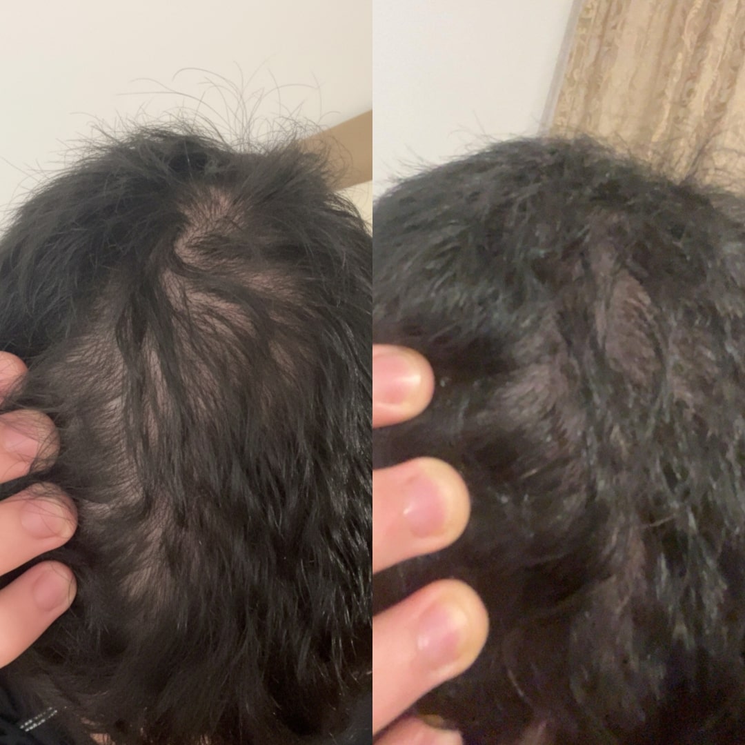 rastezh_na_kosa_transformacia1