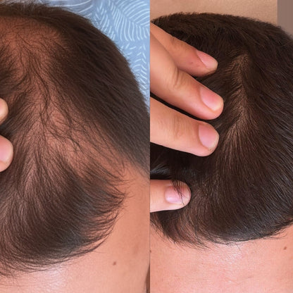 rastezh_na_kosa_transformacia2