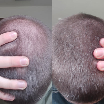 rastezh_na_kosa_transformacia4