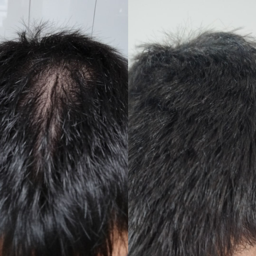 rastezh_na_kosa_transformacia9