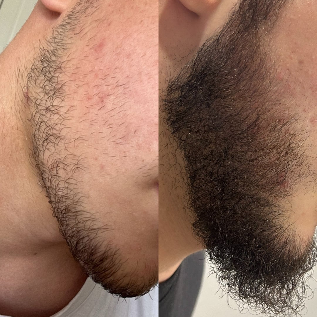 transformaciya_rastezh_na_brada_predi_sled